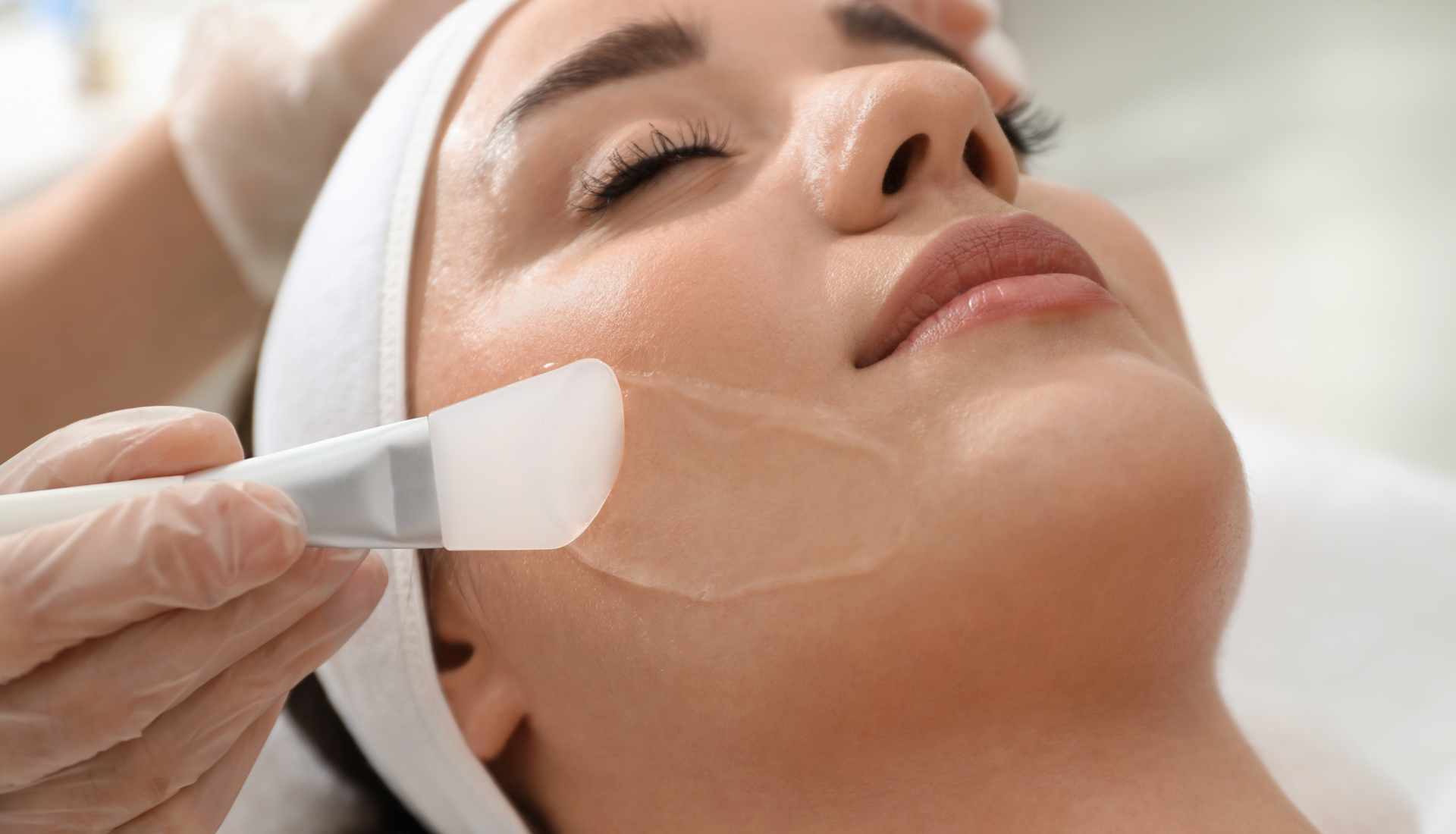 Polypeel kuorinta asiakkaalle Klinikka Luxilla